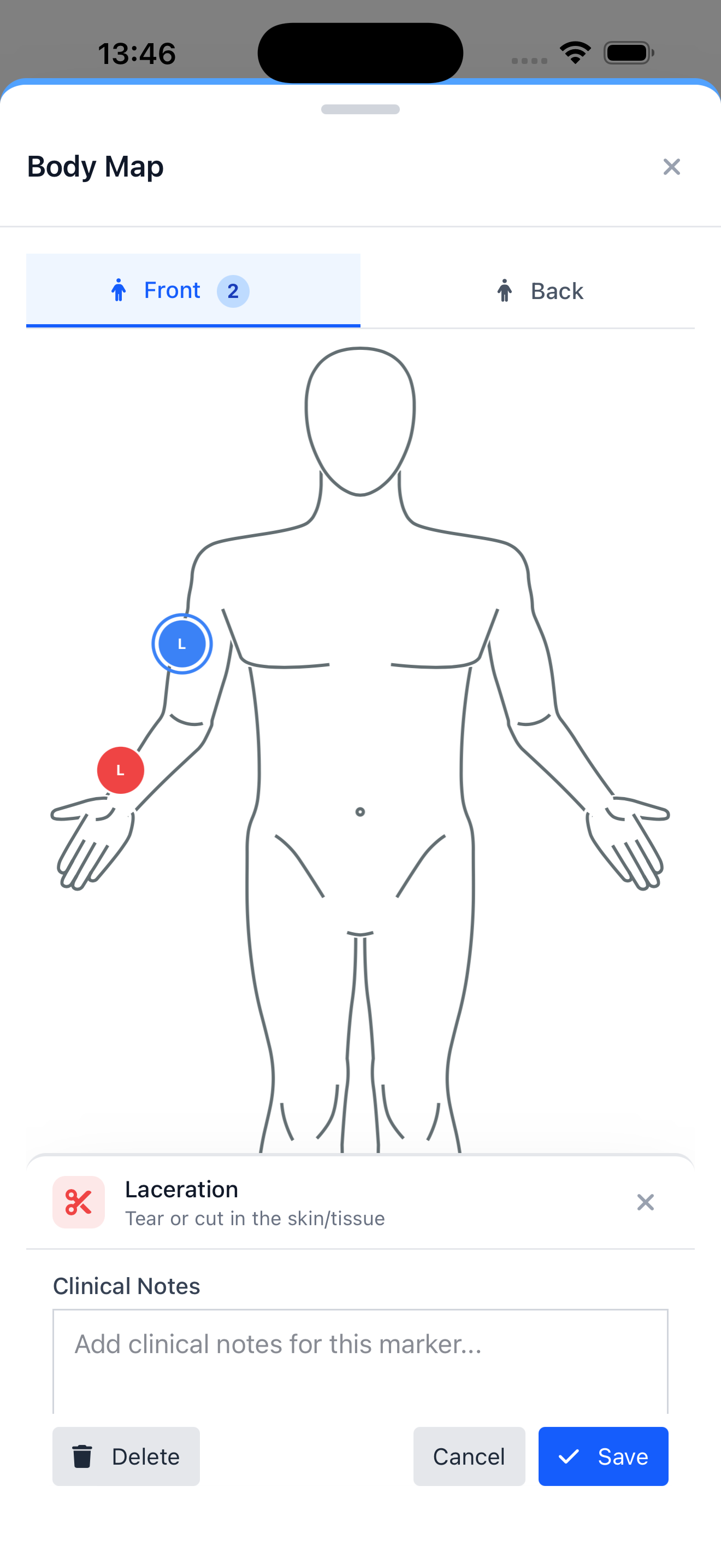 Injury Marker Selection